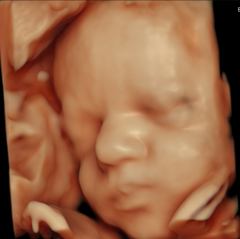 best face 29 wk hdlive best face 29 wk hdlive